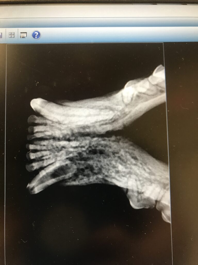 dental radiograph lower jaw